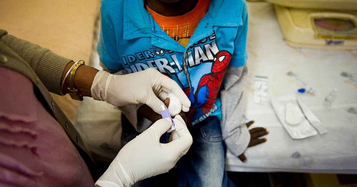 Funding for AIDS relief program to stop after foreign aid pause ordered